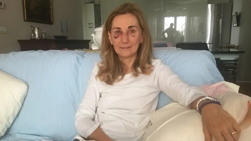 Francesca Redaelli, la professoressa picchiata alla media di Selvazzano