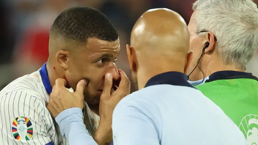 epa11418971 Kylian Mbappe of France gets medical treatment during the UEFA EURO 2024 group D soccer match between Austria and France, in Dusseldorf, Germany, 17 June 2024. EPA/FRIEDEMANN VOGEL
