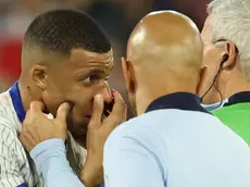 epa11418971 Kylian Mbappe of France gets medical treatment during the UEFA EURO 2024 group D soccer match between Austria and France, in Dusseldorf, Germany, 17 June 2024. EPA/FRIEDEMANN VOGEL