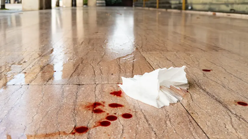 Le macchie di sangue che testimoniano la violenza in piazza De Gasperi