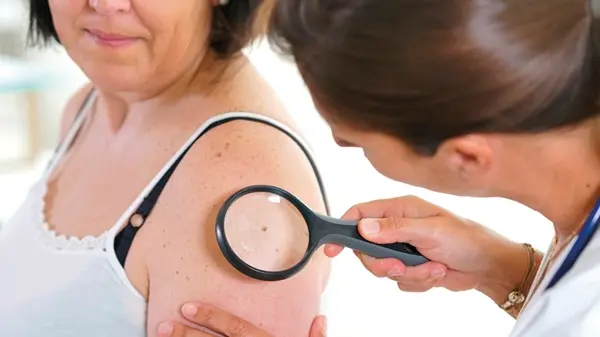 Una visita dermatologica