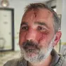 Francesco Sorgon di Cavaso del Tomba aggredito dopo essere stato invitato a un appuntamento