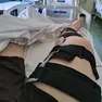 L’uomo ha riportato una lesione alla gamba destra