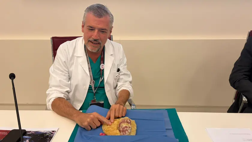 Il professor Dal Moro con il modello di rene