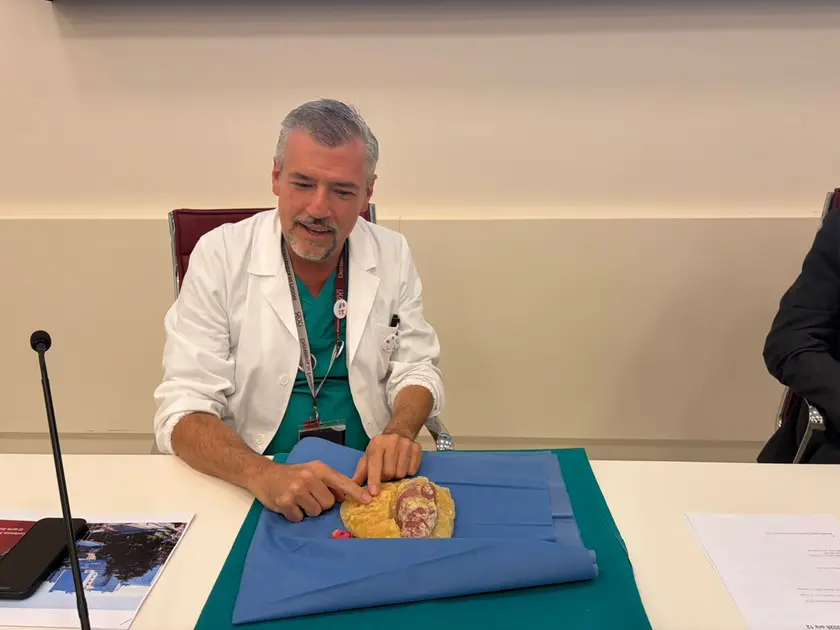 Il professor Dal Moro con il modello di rene