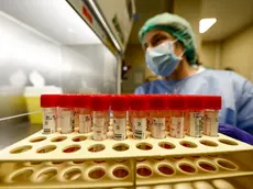 Elaborato il piano regionale per fronteggiare l'hantavirus