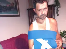 Il braccio ferito