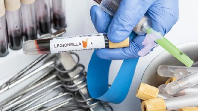 A Padova e provincia 38 casi di Legionella