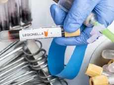 A Padova e provincia 38 casi di Legionella