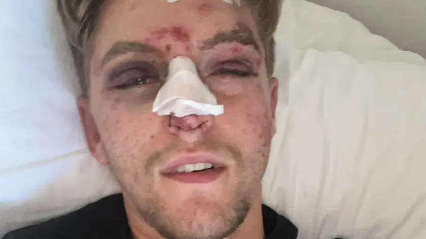 Daniel Fontana, cuoco bellunese aggredito a Jesolo