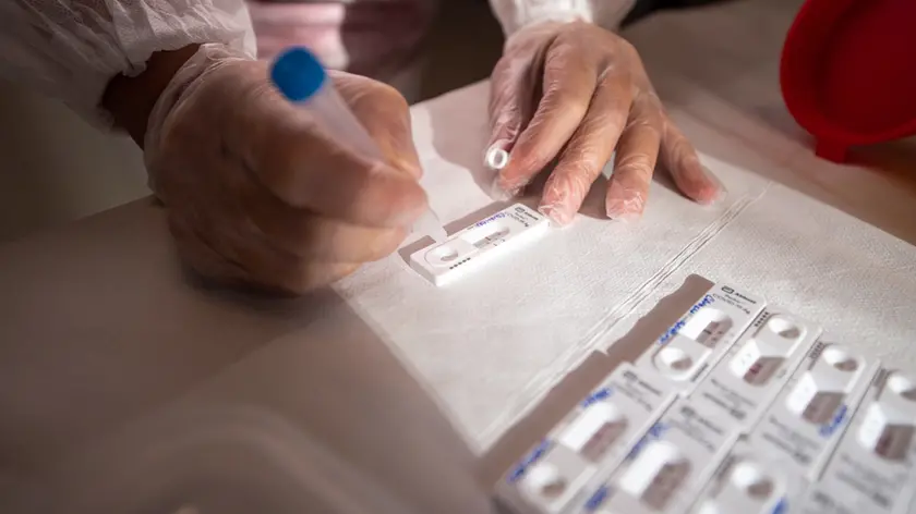 L'elaborazione di un test rapido per la ricerca del coronavirus
