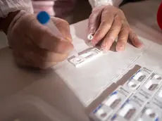 L'elaborazione di un test rapido per la ricerca del coronavirus