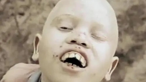 Un fermo immagine tratto dal docufilm 'White Shadow' che narra la storia di un ragazzo albino della Tanzania, vittima di persecuzione e pregiudizi. Il film, prodotto da Ryan Gosling e firmato Noaz Deshe, passerà alla 28. Settimana Internazionale della Critica al festival di Venezia, 10 agosto 2013. ANSA/