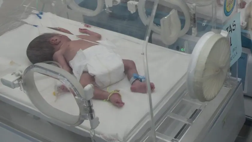 Un neonato in ospedale in una foto d'ARCHIVIO. ANSA