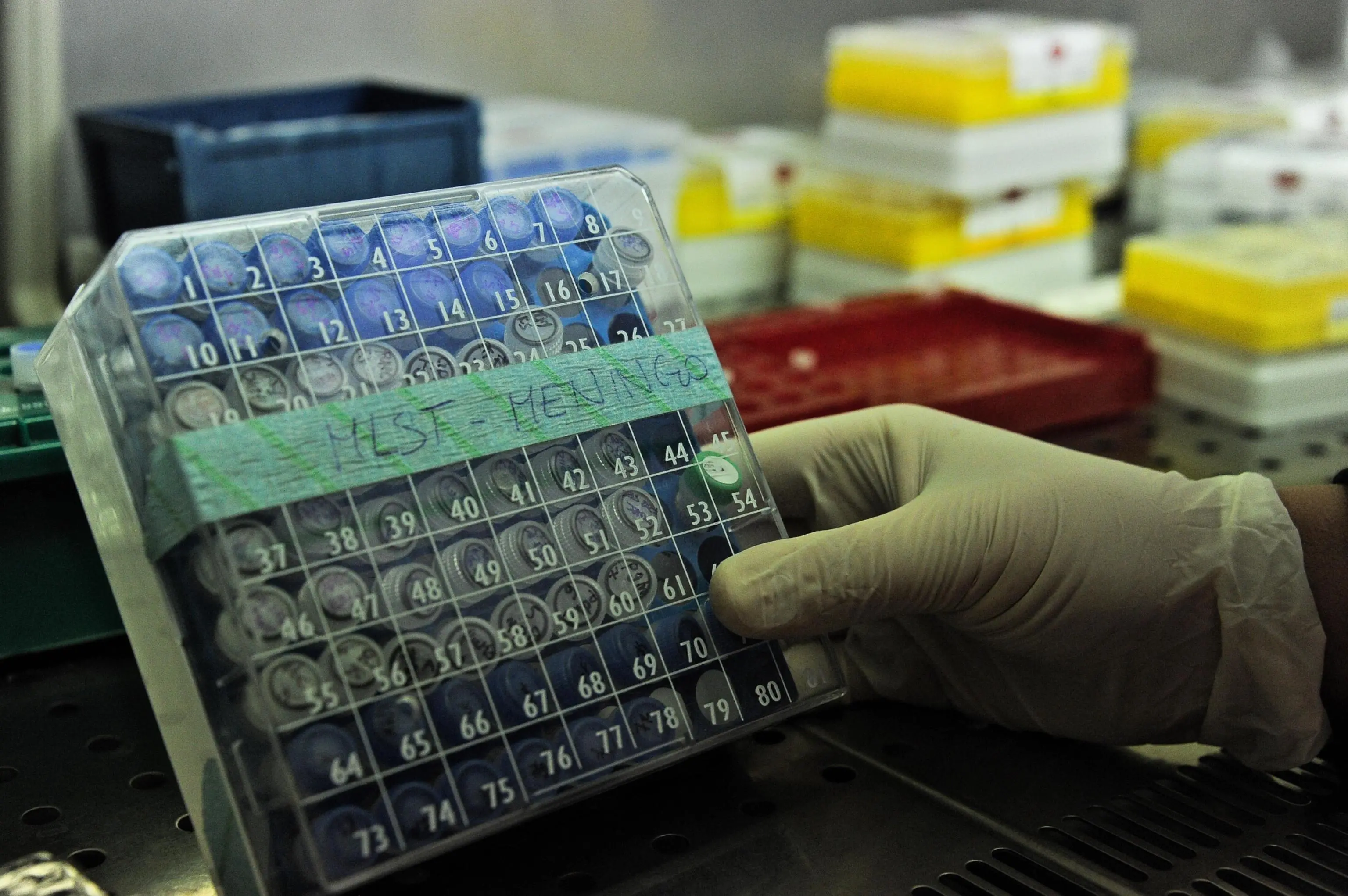 Personale dell'Ospedale pediatrico Meyer di Firenze al lavoro nel laboratorio di immunologia della struttura sanitaria, 23 novembre 2016..ANSA / MAURIZIO DEGL'INNOCENTI
