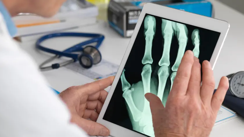 Doctor viewing X-ray