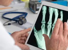 Doctor viewing X-ray