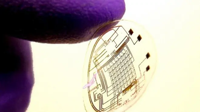 Permettere ai non vedenti di riacquistare la vista potrebbe essere possibile grazie ad ''una lente a contatto bionica, sulla quale e' applicato un microchip che funziona come una telecamera, in grado di trasmettere il segnale ad un sistema wireless applicato nelle vie retrocorticali''. E' il sistema, finora sperimentato con successo solo su animali da laboratorio (per un intervallo di tempo limitato), presentato da Duilio Siravo, presidente dell'Accademia Italiana Oftalmologia Legale, in occasione del 9° Congresso Internazionale della Societa' Oftalmologica Italiana, che si e' aperto oggi a Roma. ANSA +++EDITORIAL USE ONLY - NO SALES+++