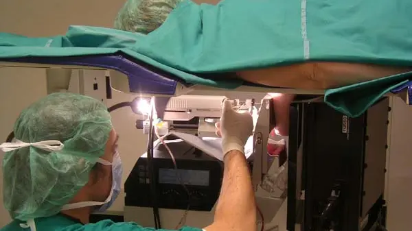 BIOPSIA IN CORSO CON SISTEMA MAMMOTOME