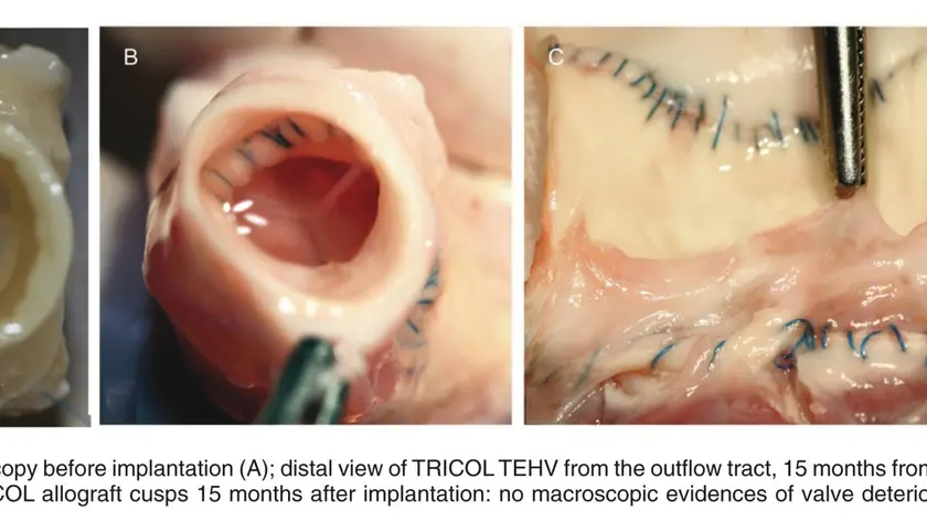 Valvole cardiache ricavate da tessuto animale
