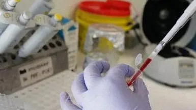 Esami clinici in un laboratorio analisi ANSA