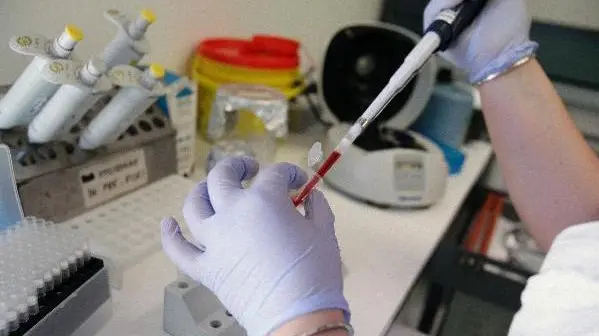 Esami clinici in un laboratorio analisi ANSA