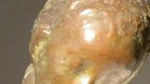 Il 'Bambino malato' di Medardo Rosso in un'immagine d'archivio. L'opera, esposta alla Galleria nazionale d'arte moderna a Roma, e' stata ritrovata, dopo essere stata trafugata, in un armadietto aperto al pubblico dello stesso Museo, l'8 dicembre 2014. ANSA/ MAURIZIO BRAMBATTI