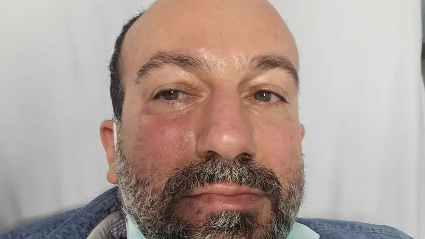 Alfonso D’Ambrosio, dirigente scolastico dell’Istituto comprensivo di Lozzo Atestino, aggredito da un ciclista